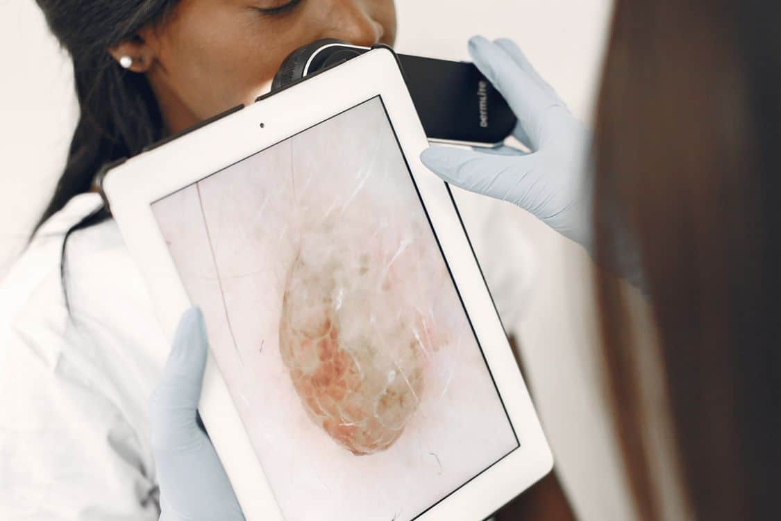 A dermatologist using advanced technology for a skin examination - $10 million federal campaign puts National Skin Cancer Action Week back in the spotlight
